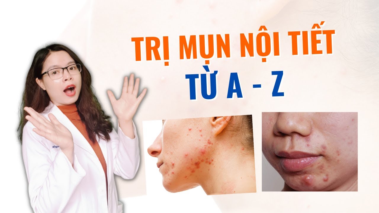 Điều Trị Mụn Hiệu Quả Tại Bắc Giang Hướng Dẫn  Địa Chỉ Uy Tín