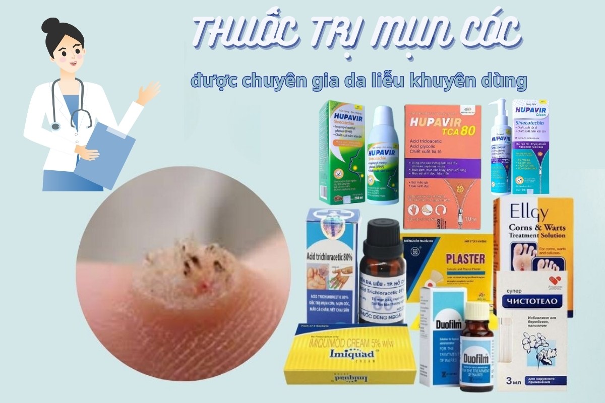 Điều trị mụn Bình Thuận Giải pháp toàn diện cho làn da sạch mịn