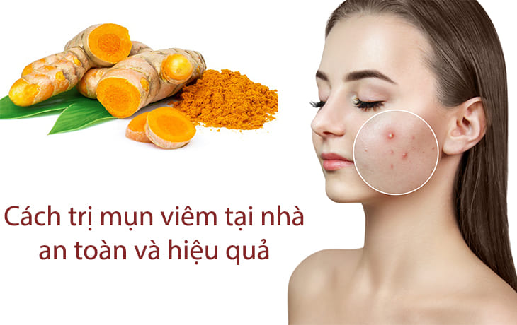 Điều trị mụn viêm hà nội