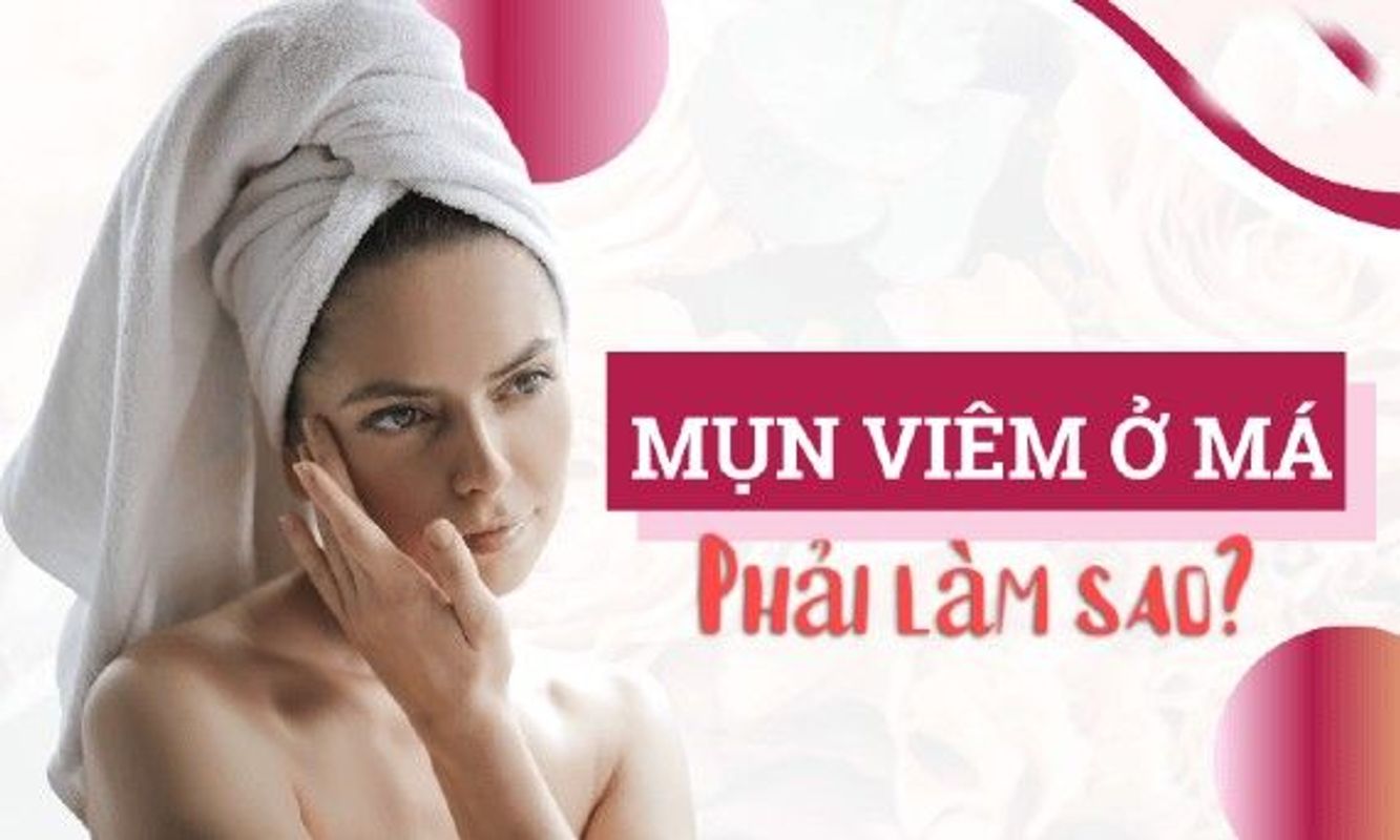 Điều trị mụn viêm hà nội