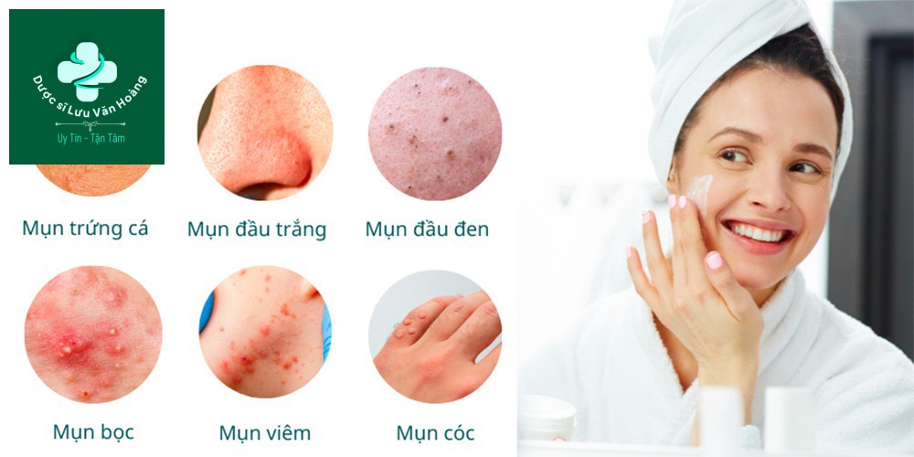 Điều trị mụn viêm hà nội