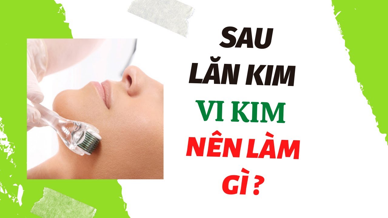 Điều trị mụn Vĩnh Phúc