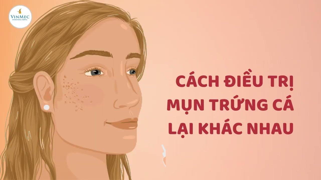 Trị Mụn Cám Giải Pháp Toàn Diện Cho Làn Da Sáng Khỏe