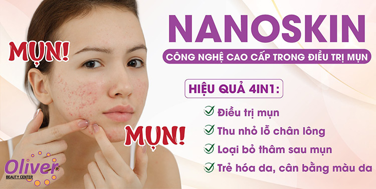 Điều Trị Mụn Giải pháp Toàn diện và Hiệu quả cho Làn Da Sạch Mịn