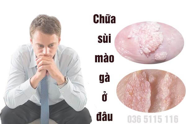 Điều Trị Mụn Thịt Hiệu Quả Tại Hà Nội